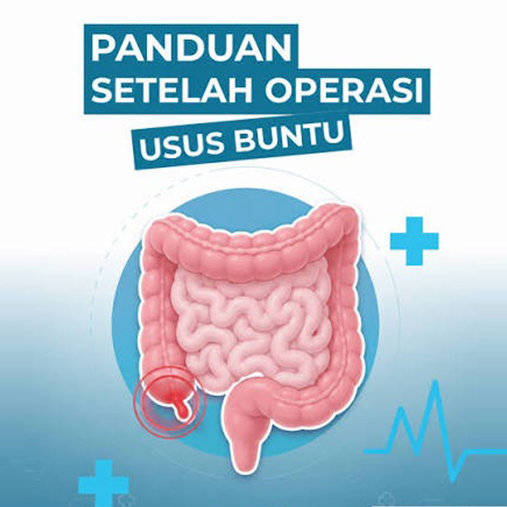 Gambar untuk Panduan Perawatan Pasca Operasi Usus Buntu di Rumah